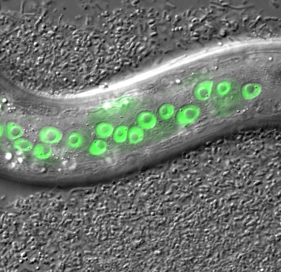 Protein Degradation