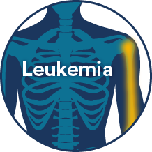 leukemia